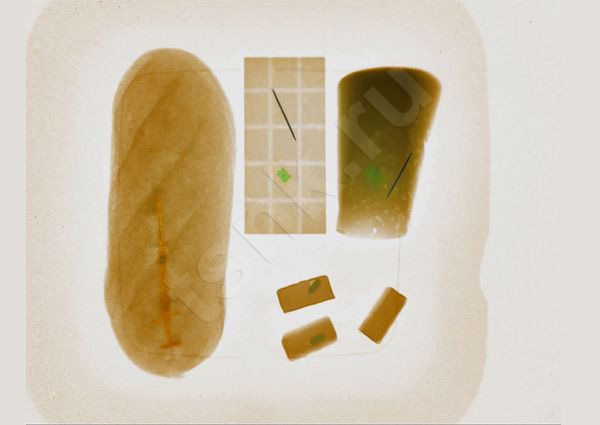 Рентгенотелевизионная установка Калан-2М