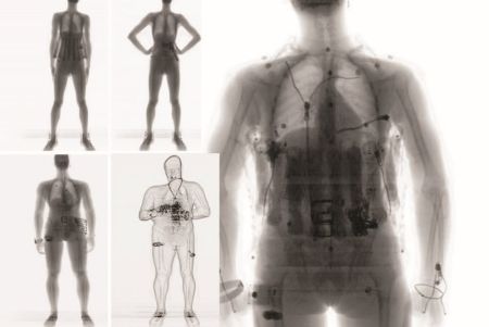 Микродозовая установка персонального досмотра Персона-Скан